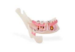 Demo Pathologisches halbes UK Modell P13-TR10